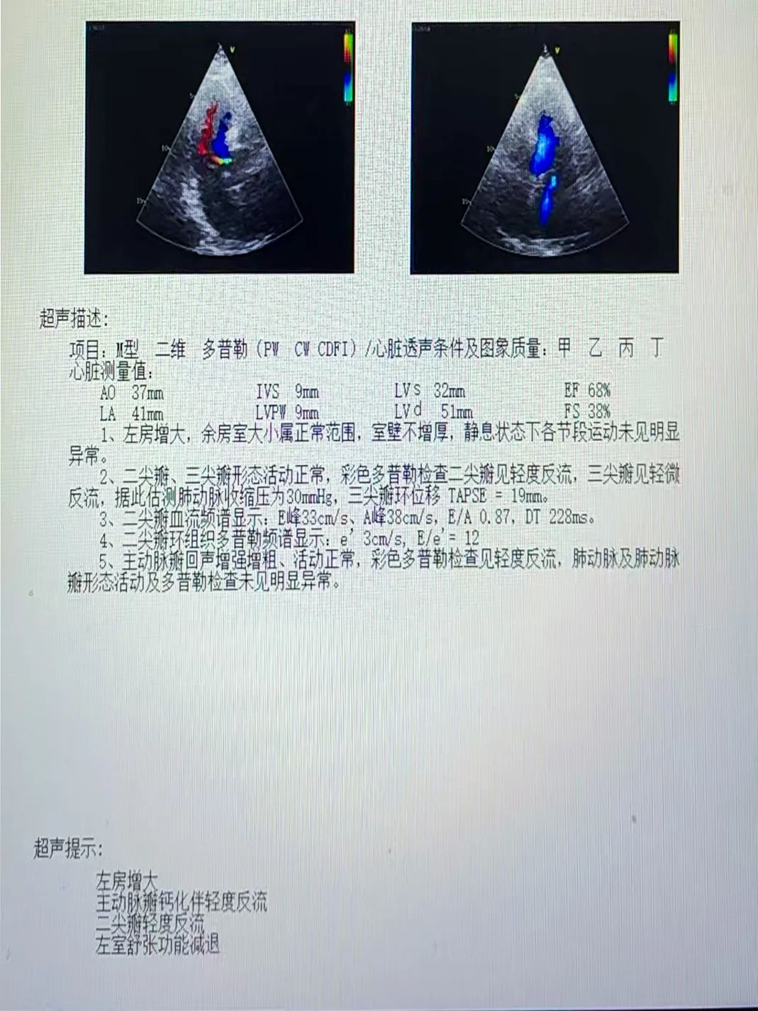 ͼƬ