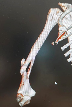 ͼƬ