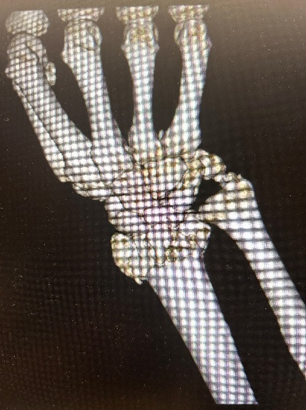 ͼƬ