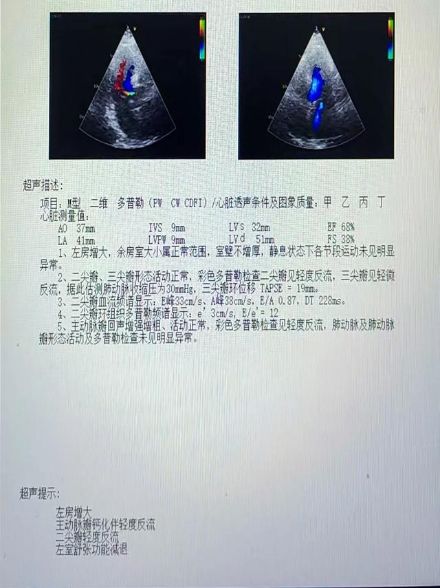 DƬ